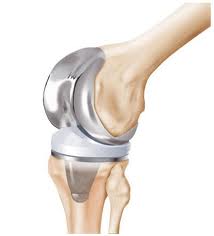 Dr. Victor participou como palestrante do Knee Academy